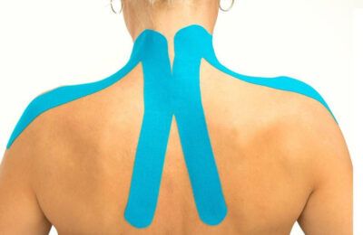 Kinesiotape Tratamiento fisioterapia