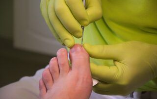 podólogo cortando las uñas de los pies